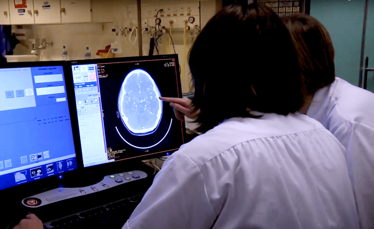 Día Mundial del Accidente Cerebrovascular: el método para identificar los síntomas de forma temprana 